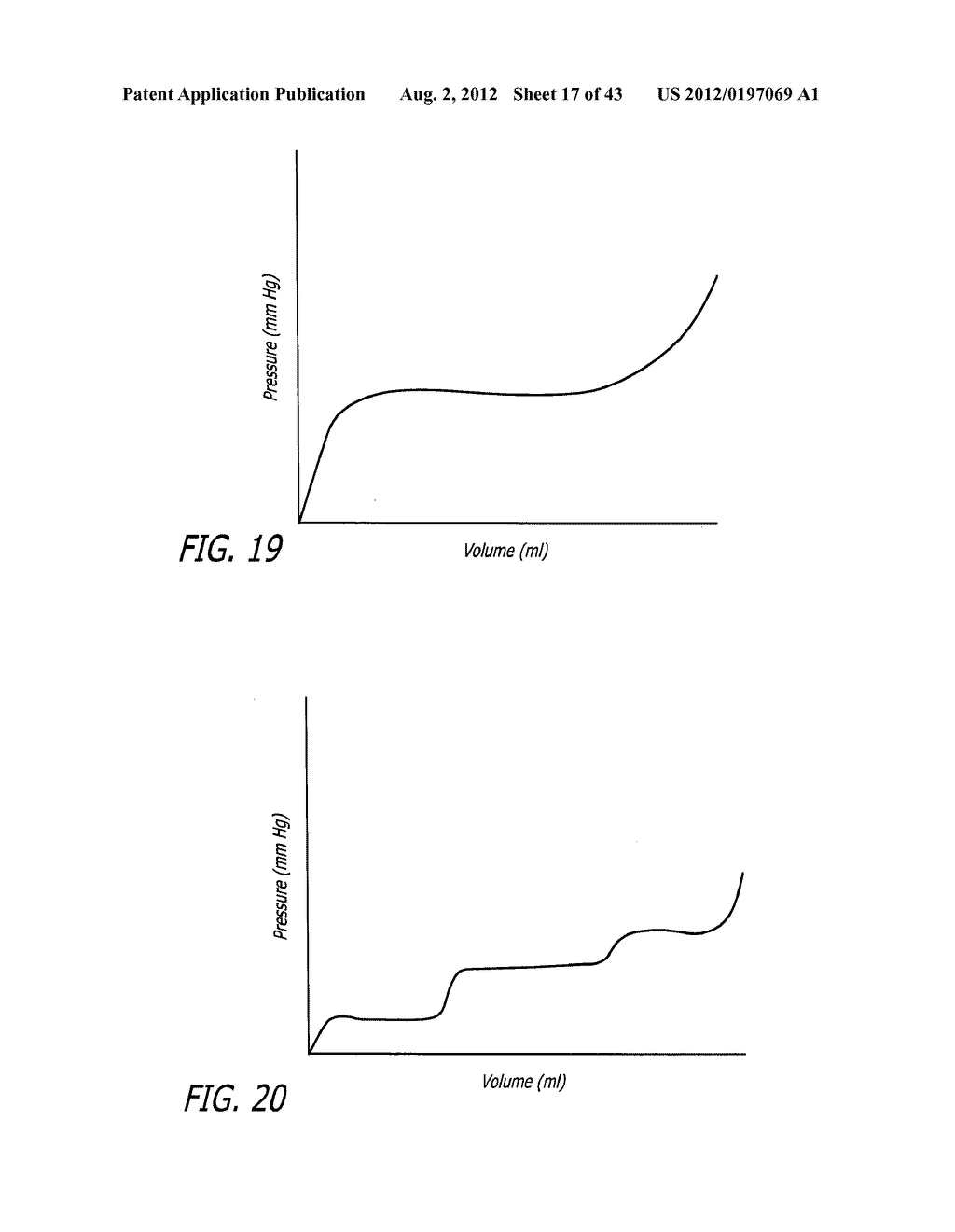 ASSEMBLY AND METHOD FOR AUTOMATICALLY CONTROLLING PRESSURE FOR A GASTRIC     BAND - diagram, schematic, and image 18