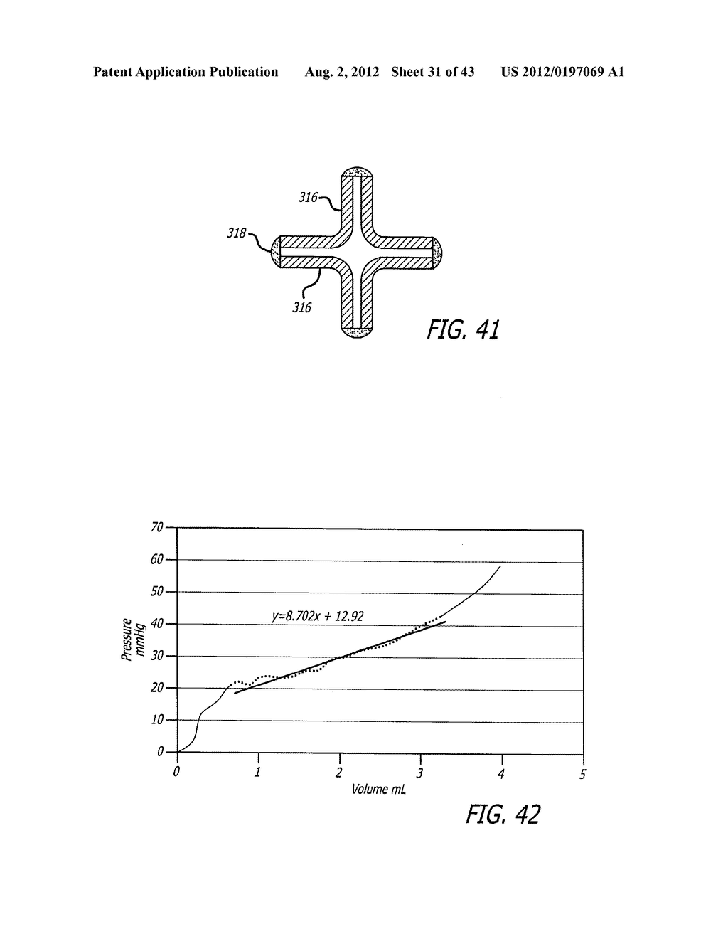 ASSEMBLY AND METHOD FOR AUTOMATICALLY CONTROLLING PRESSURE FOR A GASTRIC     BAND - diagram, schematic, and image 32