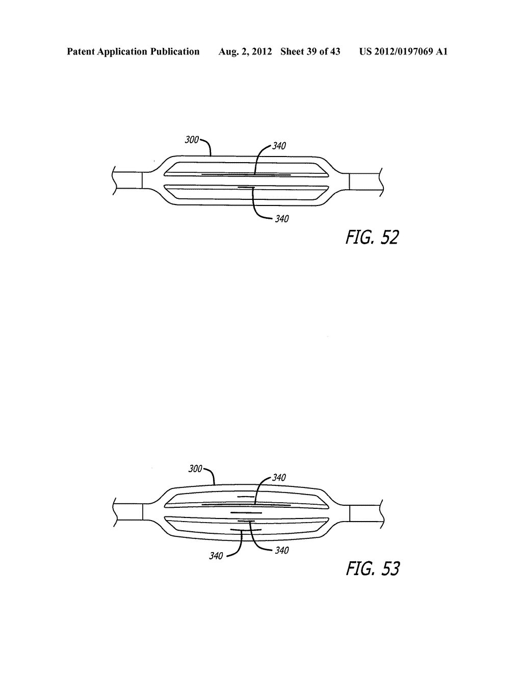 ASSEMBLY AND METHOD FOR AUTOMATICALLY CONTROLLING PRESSURE FOR A GASTRIC     BAND - diagram, schematic, and image 40