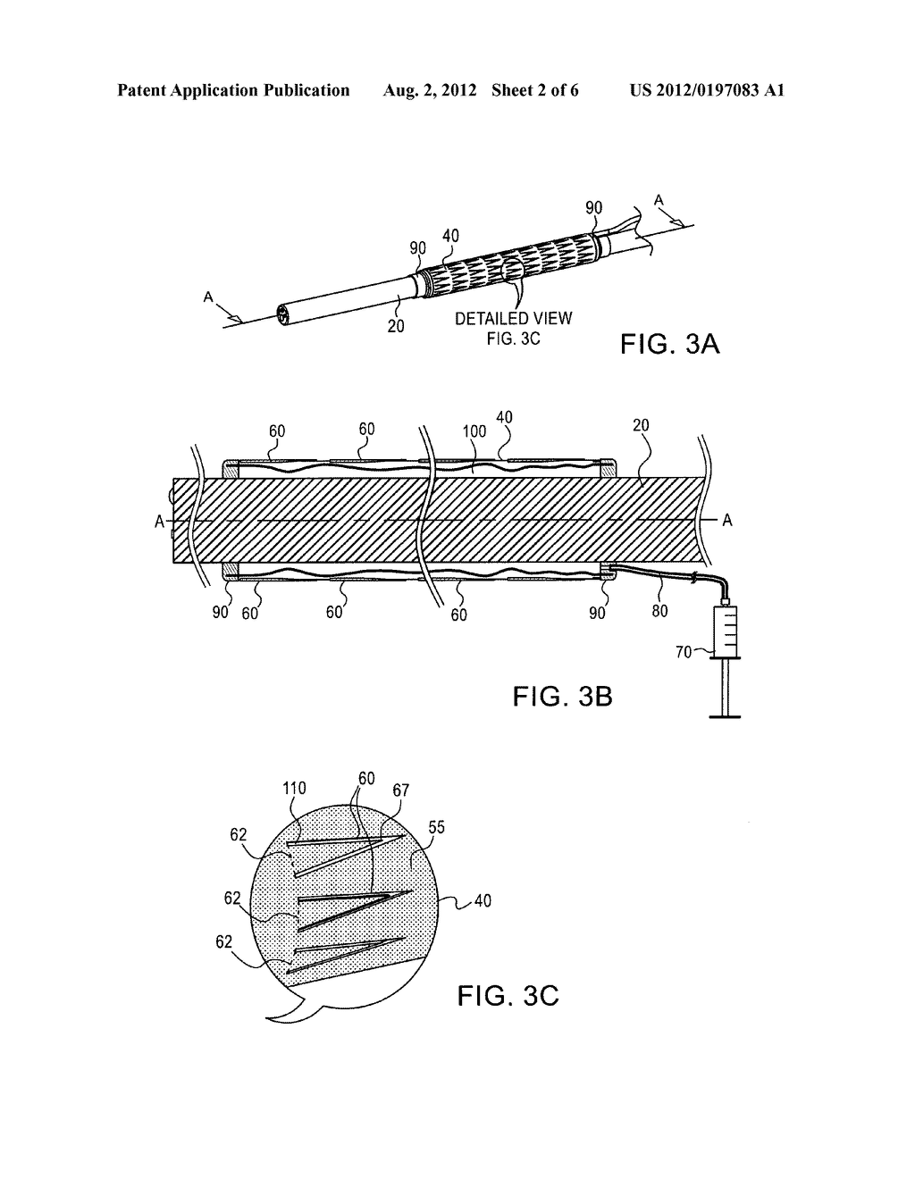 METHOD AND APPARATUS FOR ENDOSCOPE ADVANCEMENT - diagram, schematic, and image 03