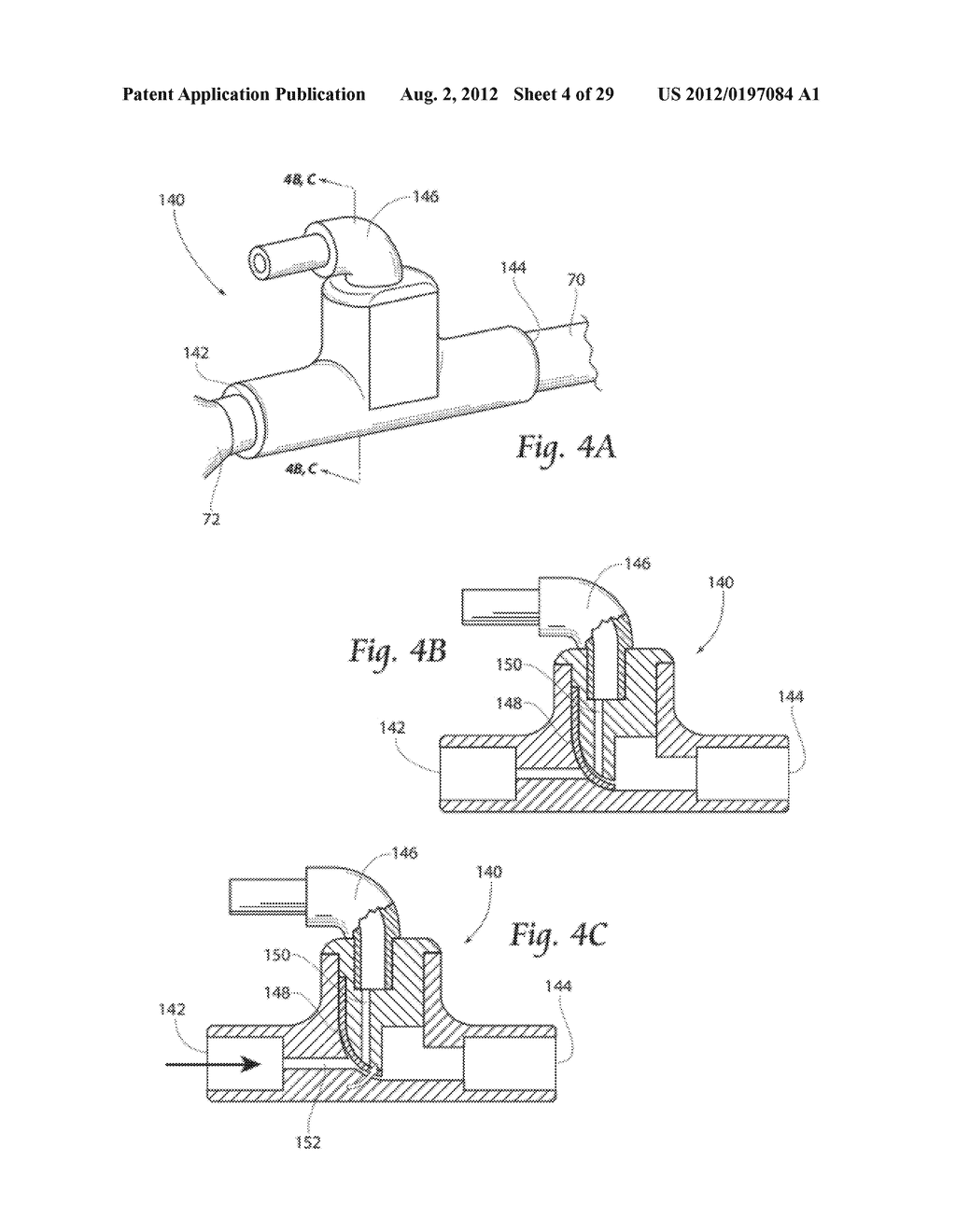 SYSTEMS AND METHODS FOR OPTIMIZING AND MAINTAINING VISUALIZATION OF A     SURGICAL FIELD DURING THE USE OF SURGICAL SCOPES - diagram, schematic, and image 05