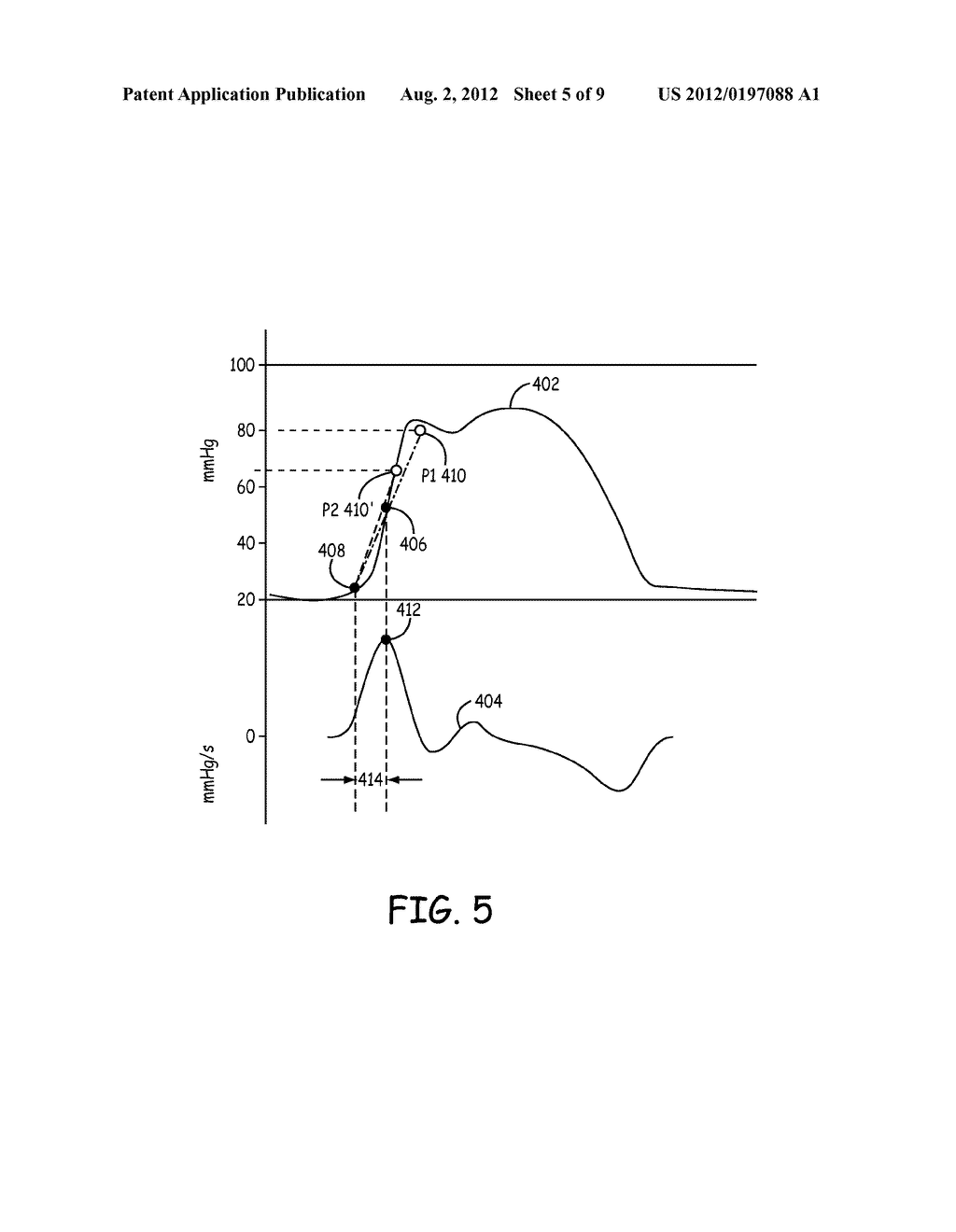 DETECTION OF WAVEFORM ARTIFACT - diagram, schematic, and image 06