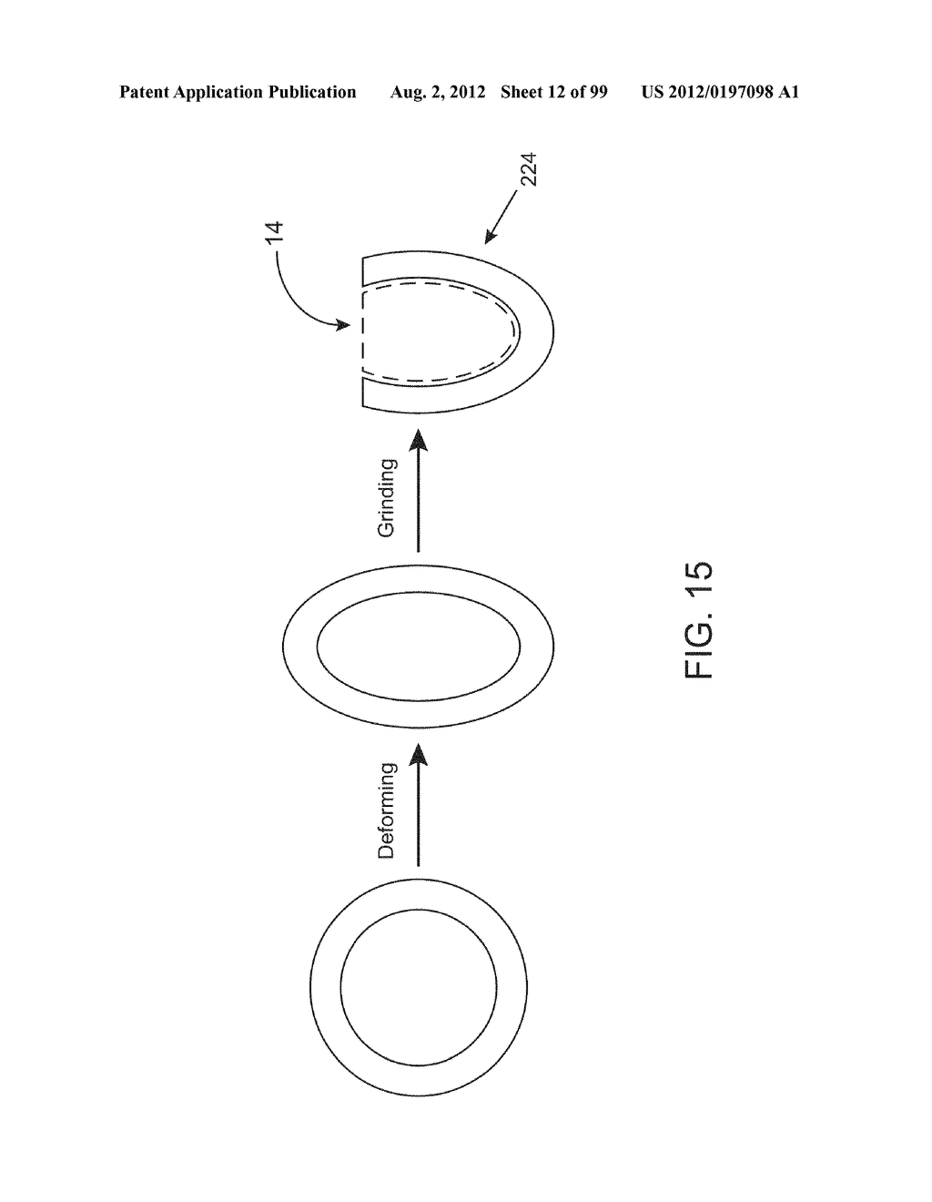 Medical Device Inserters and Processes of Inserting and Using Medical     Devices - diagram, schematic, and image 13