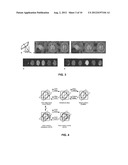 SYSTEM AND METHODS FOR AUTOMATIC PLACEMENT OF SPATIAL SUPRESSION REGIONS     IN MRI AND MRSI diagram and image