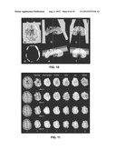 SYSTEM AND METHODS FOR AUTOMATIC PLACEMENT OF SPATIAL SUPRESSION REGIONS     IN MRI AND MRSI diagram and image