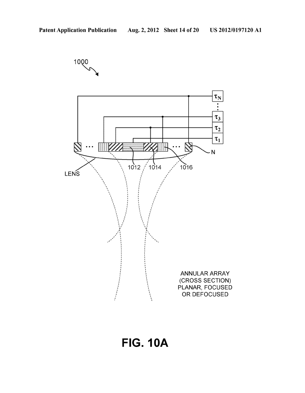 METHODS FOR TREATMENT OF SWEAT GLANDS - diagram, schematic, and image 15