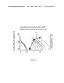 Transthoracic Cardio-Pulmonary Monitor diagram and image