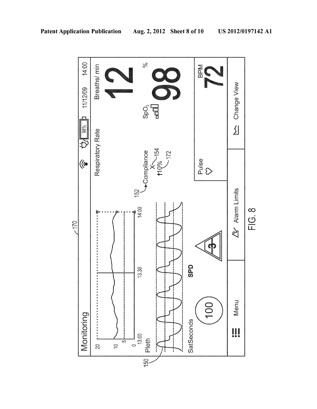 Method And System For Determining Vascular Changes Using Plethysmographic     Signals - diagram, schematic, and image 09