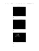 ULTRASOUND COUPLANT diagram and image