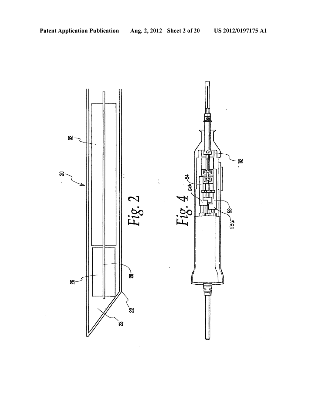 METHODS, SYSTEMS AND APPARATUS FOR RELIEVING PRESSURE IN AN ORGAN - diagram, schematic, and image 03