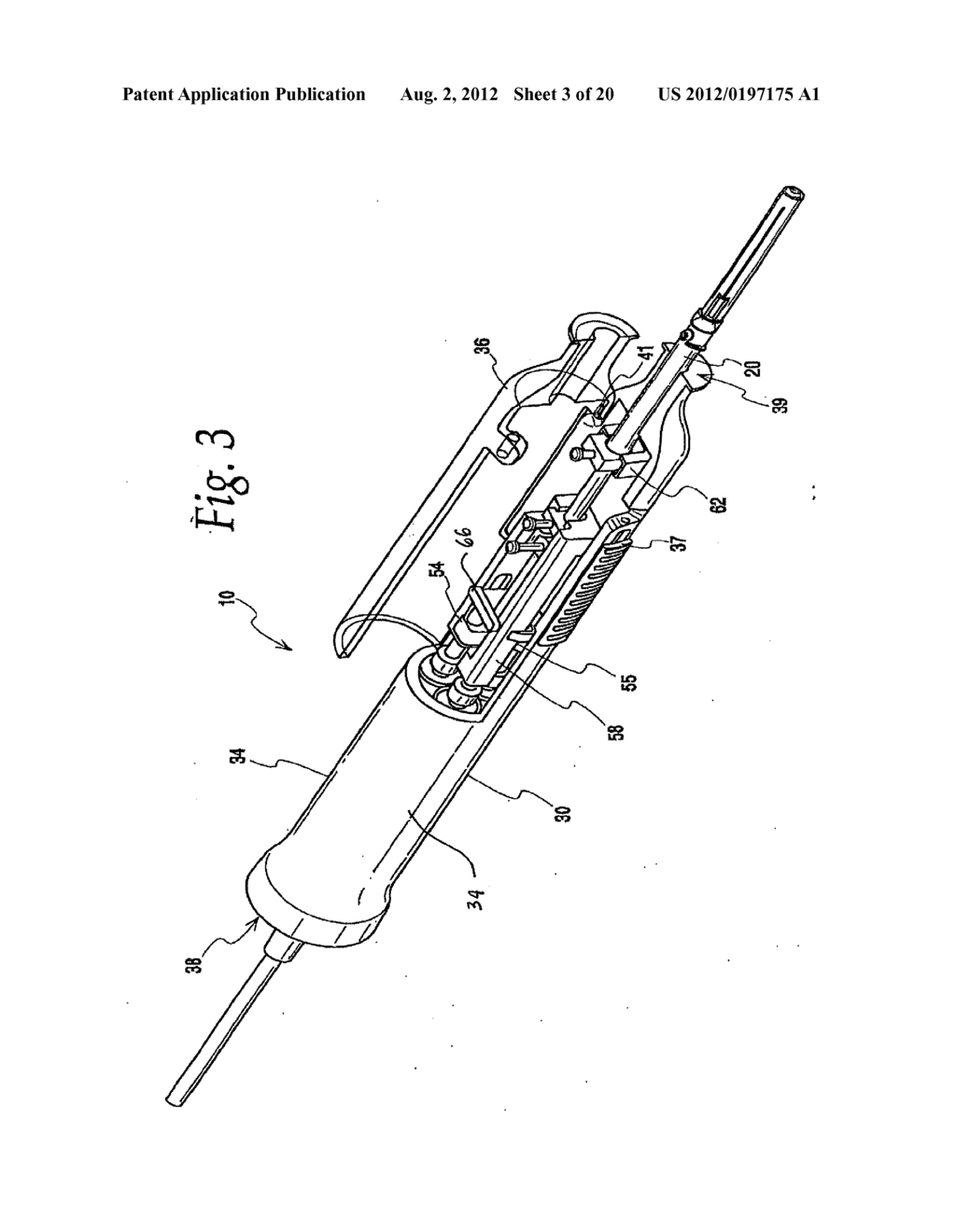 METHODS, SYSTEMS AND APPARATUS FOR RELIEVING PRESSURE IN AN ORGAN - diagram, schematic, and image 04