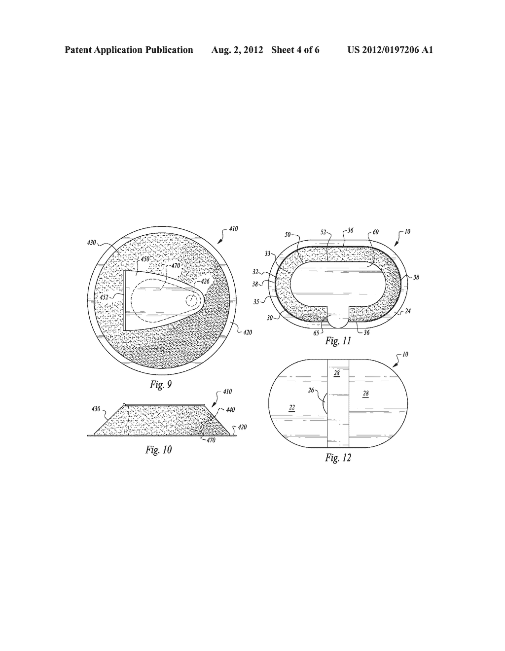 ADHESIVE DRESSING WITH RESEALABLE COVER - diagram, schematic, and image 05