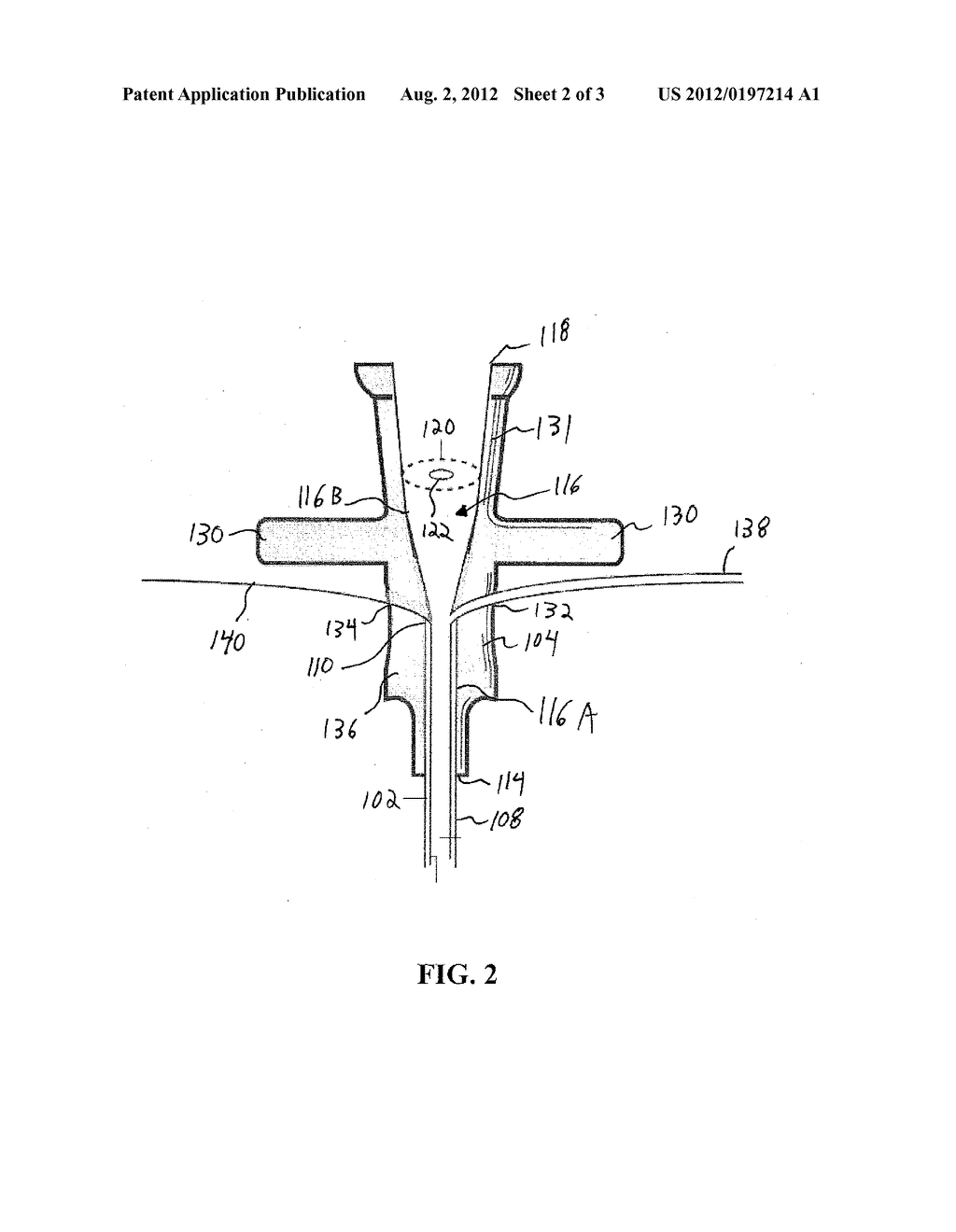 PERIPHERAL NERVE BLOCKADE DEVICE - diagram, schematic, and image 03