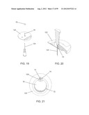 Medical Device Inserters and Processes of Inserting and Using Medical     Devices diagram and image