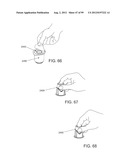 Medical Device Inserters and Processes of Inserting and Using Medical     Devices diagram and image