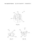 Medical Device Inserters and Processes of Inserting and Using Medical     Devices diagram and image