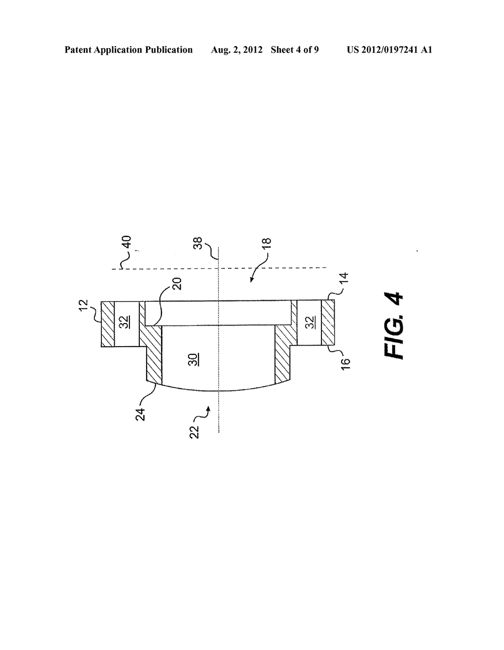 ARTICULATION JOINTS FOR TORQUE TRANSMISSION - diagram, schematic, and image 05