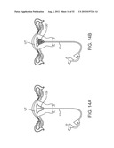 METHODS AND APPARATUS FOR CYROGENIC TREATMENT OF A BODY CAVITY OR LUMEN diagram and image