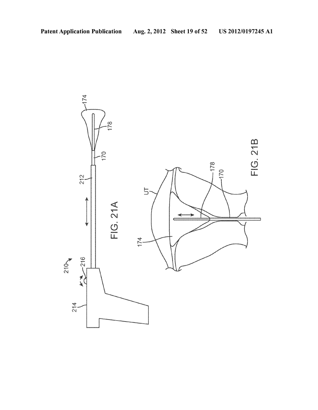 METHODS AND APPARATUS FOR CYROGENIC TREATMENT OF A BODY CAVITY OR LUMEN - diagram, schematic, and image 20