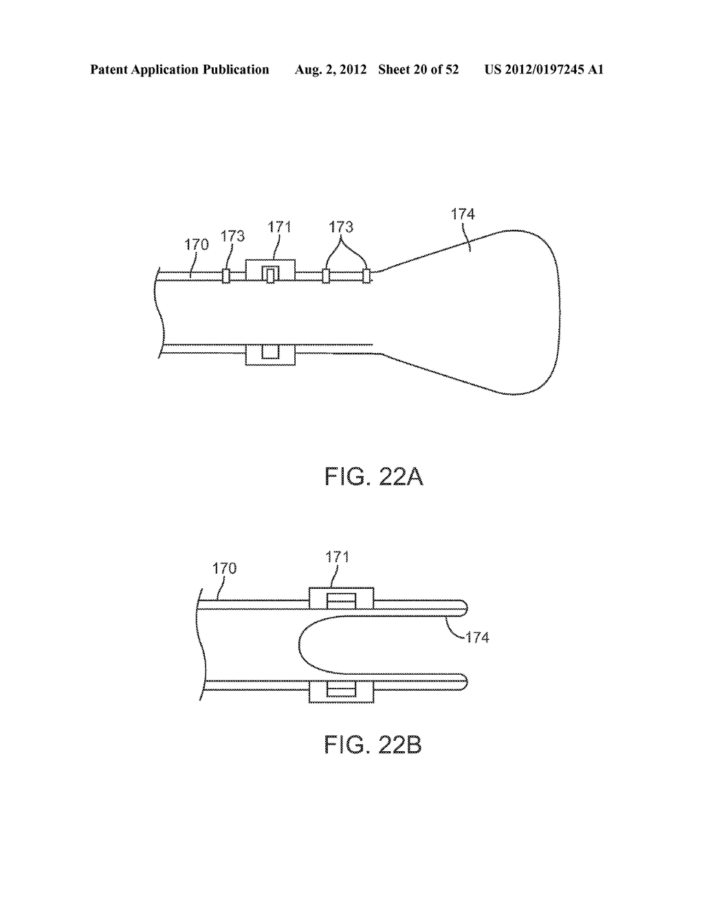 METHODS AND APPARATUS FOR CYROGENIC TREATMENT OF A BODY CAVITY OR LUMEN - diagram, schematic, and image 21
