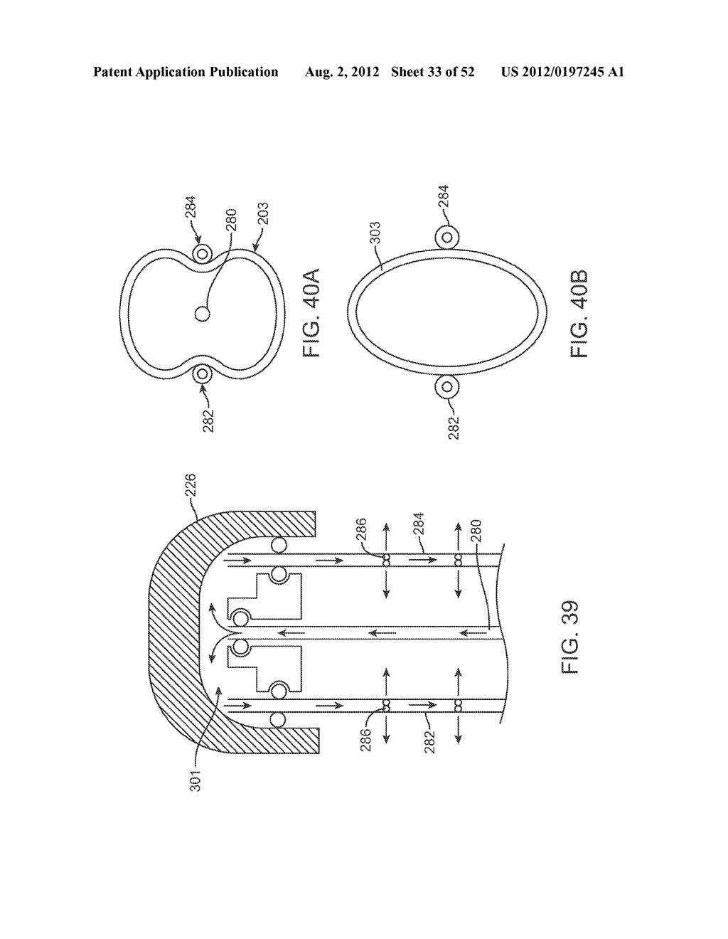 METHODS AND APPARATUS FOR CYROGENIC TREATMENT OF A BODY CAVITY OR LUMEN - diagram, schematic, and image 34