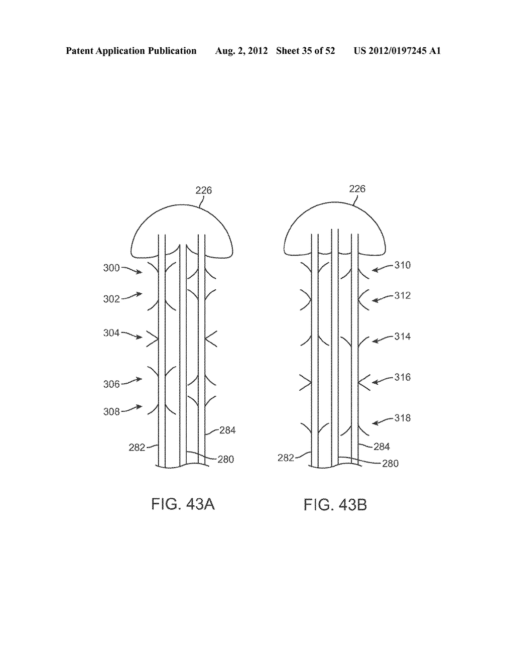 METHODS AND APPARATUS FOR CYROGENIC TREATMENT OF A BODY CAVITY OR LUMEN - diagram, schematic, and image 36
