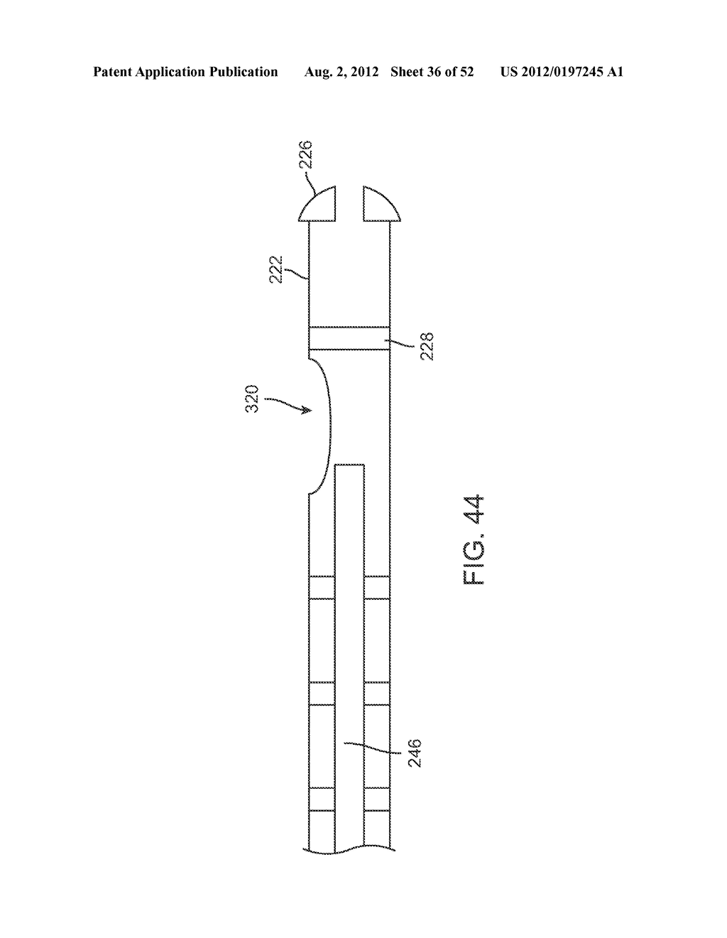 METHODS AND APPARATUS FOR CYROGENIC TREATMENT OF A BODY CAVITY OR LUMEN - diagram, schematic, and image 37
