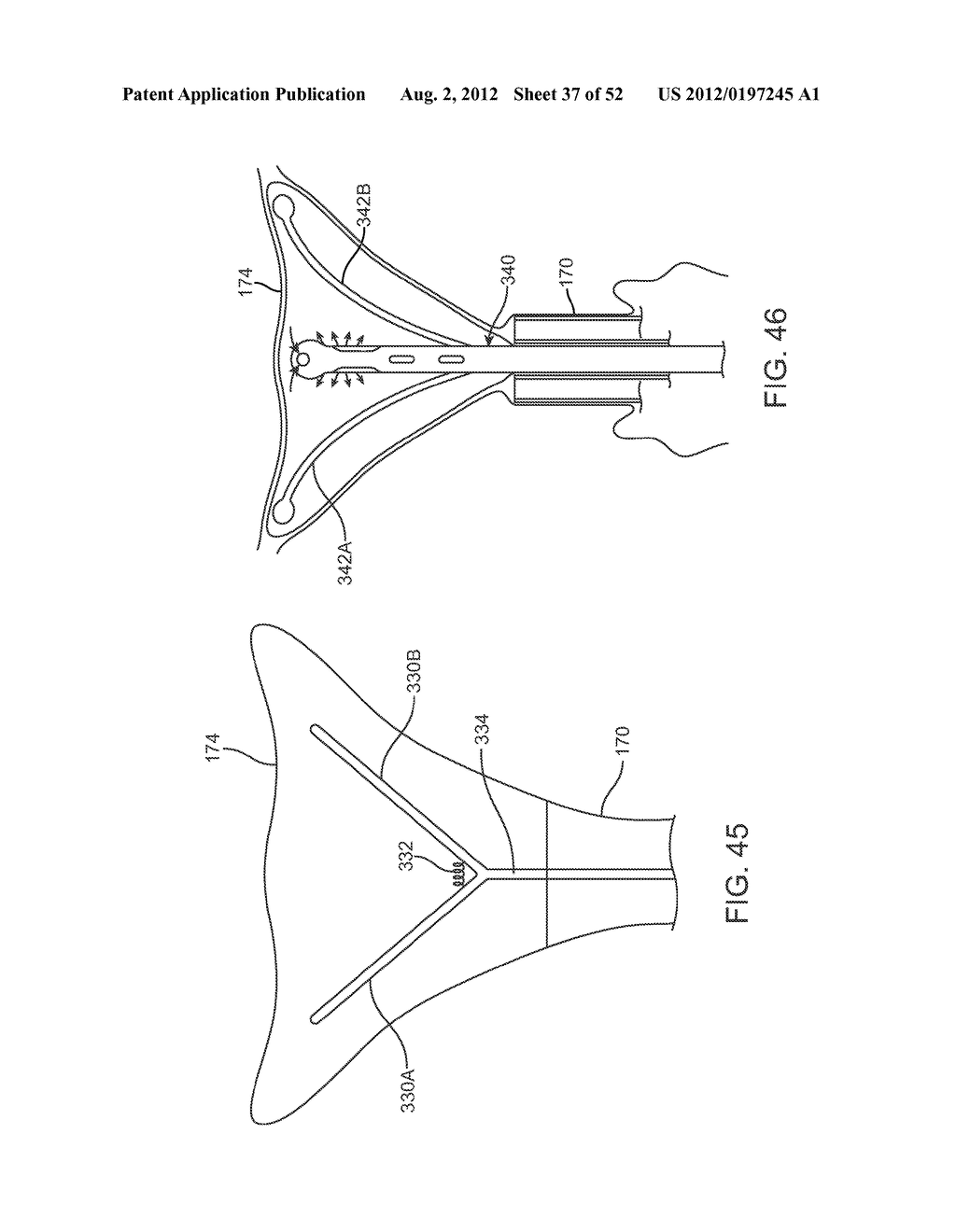 METHODS AND APPARATUS FOR CYROGENIC TREATMENT OF A BODY CAVITY OR LUMEN - diagram, schematic, and image 38