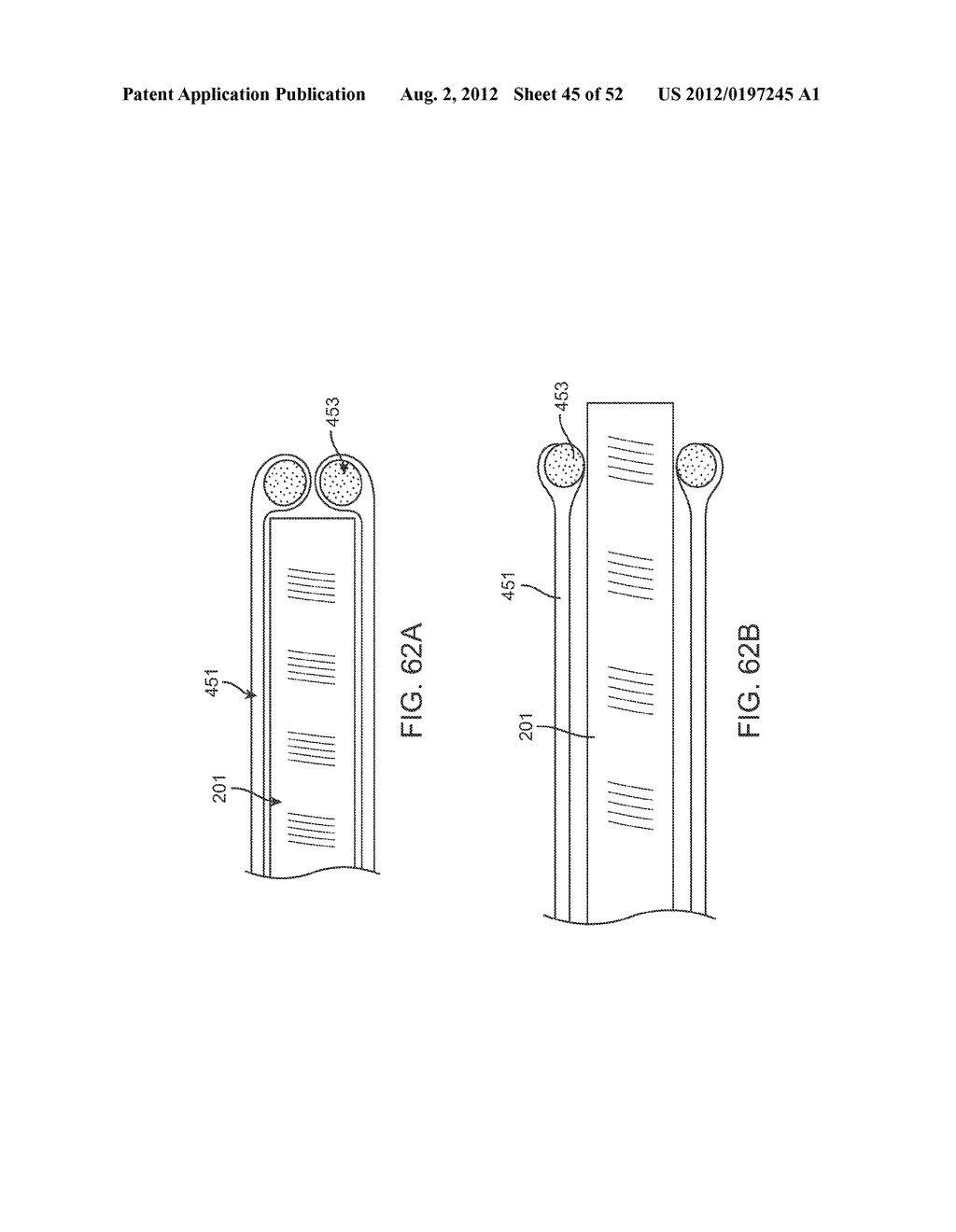 METHODS AND APPARATUS FOR CYROGENIC TREATMENT OF A BODY CAVITY OR LUMEN - diagram, schematic, and image 46