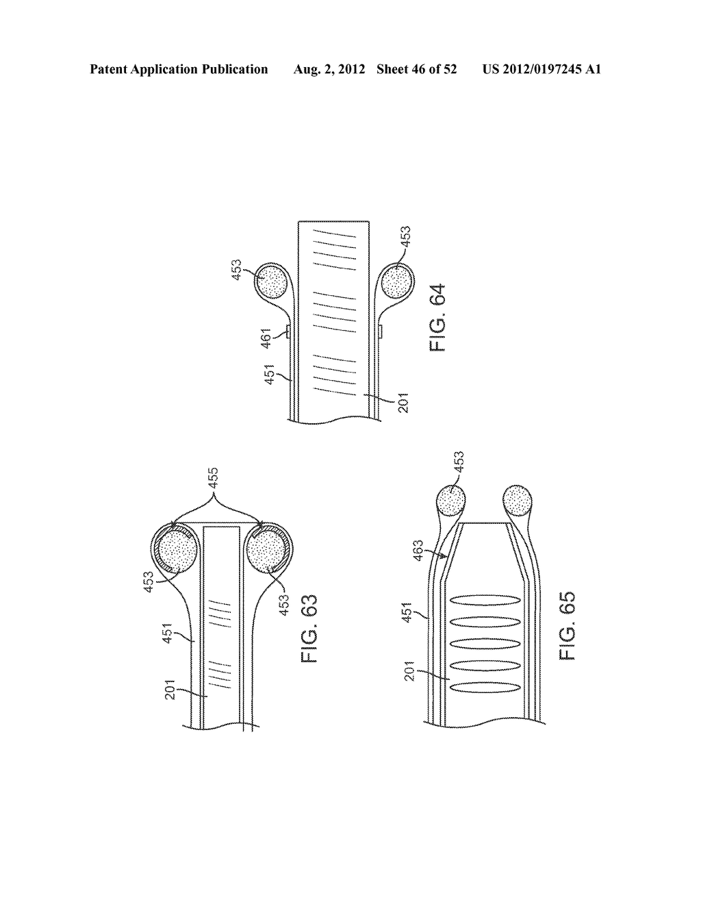 METHODS AND APPARATUS FOR CYROGENIC TREATMENT OF A BODY CAVITY OR LUMEN - diagram, schematic, and image 47