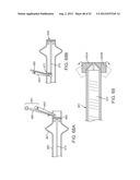 METHODS AND APPARATUS FOR CYROGENIC TREATMENT OF A BODY CAVITY OR LUMEN diagram and image