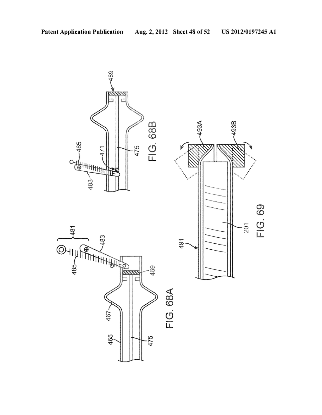 METHODS AND APPARATUS FOR CYROGENIC TREATMENT OF A BODY CAVITY OR LUMEN - diagram, schematic, and image 49