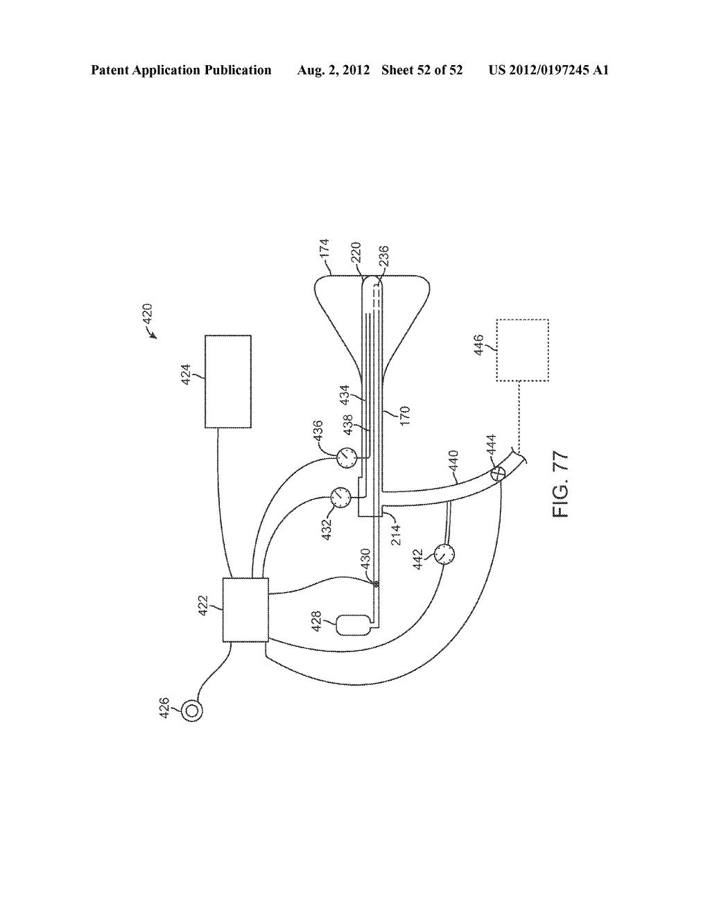 METHODS AND APPARATUS FOR CYROGENIC TREATMENT OF A BODY CAVITY OR LUMEN - diagram, schematic, and image 53