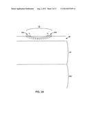 SUBCUTANEOUS ELECTRIC FIELD DISTRIBUTION SYSTEM AND METHODS diagram and image