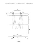 SUBCUTANEOUS ELECTRIC FIELD DISTRIBUTION SYSTEM AND METHODS diagram and image