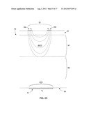 SUBCUTANEOUS ELECTRIC FIELD DISTRIBUTION SYSTEM AND METHODS diagram and image