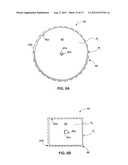 SUBCUTANEOUS ELECTRIC FIELD DISTRIBUTION SYSTEM AND METHODS diagram and image