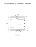 SUBCUTANEOUS ELECTRIC FIELD DISTRIBUTION SYSTEM AND METHODS diagram and image