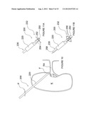 APPARATUSES FOR RENAL NEUROMODULATION diagram and image
