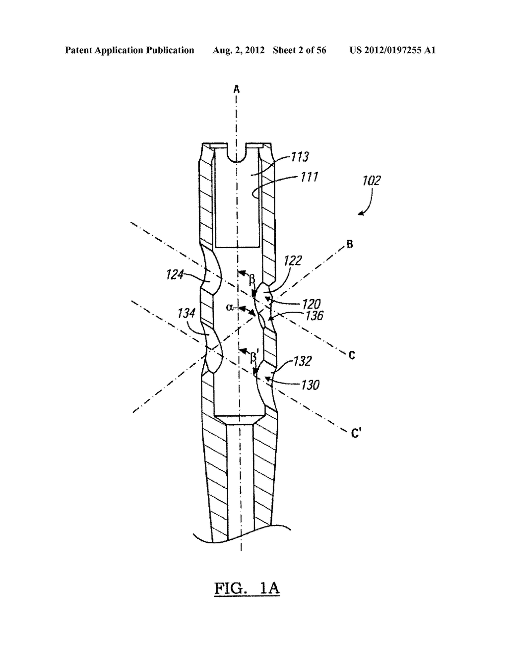 Lockable Intramedullary Fixation Device - diagram, schematic, and image 03