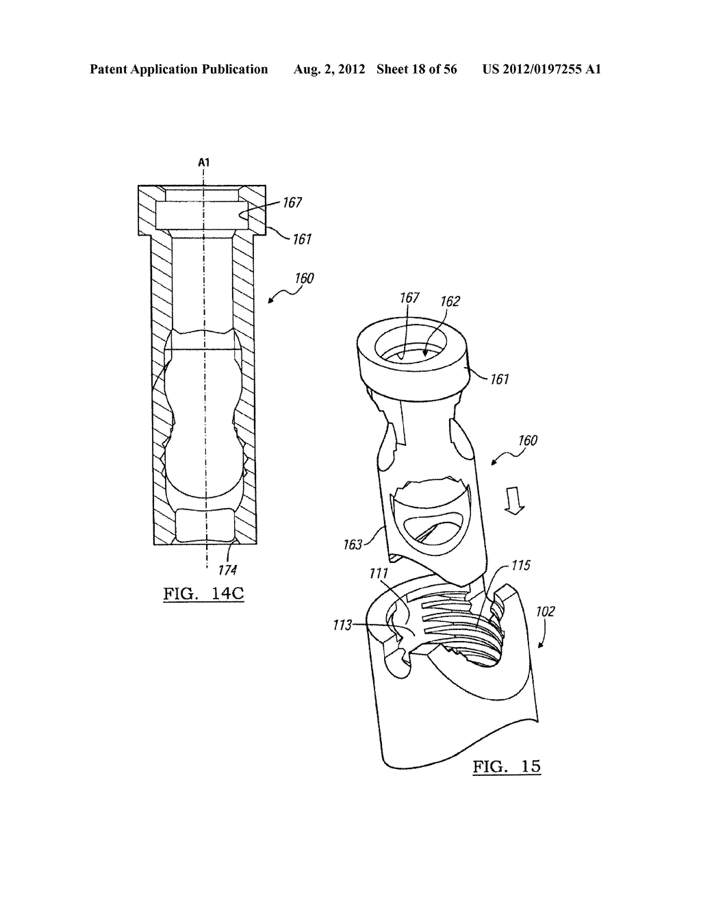 Lockable Intramedullary Fixation Device - diagram, schematic, and image 19