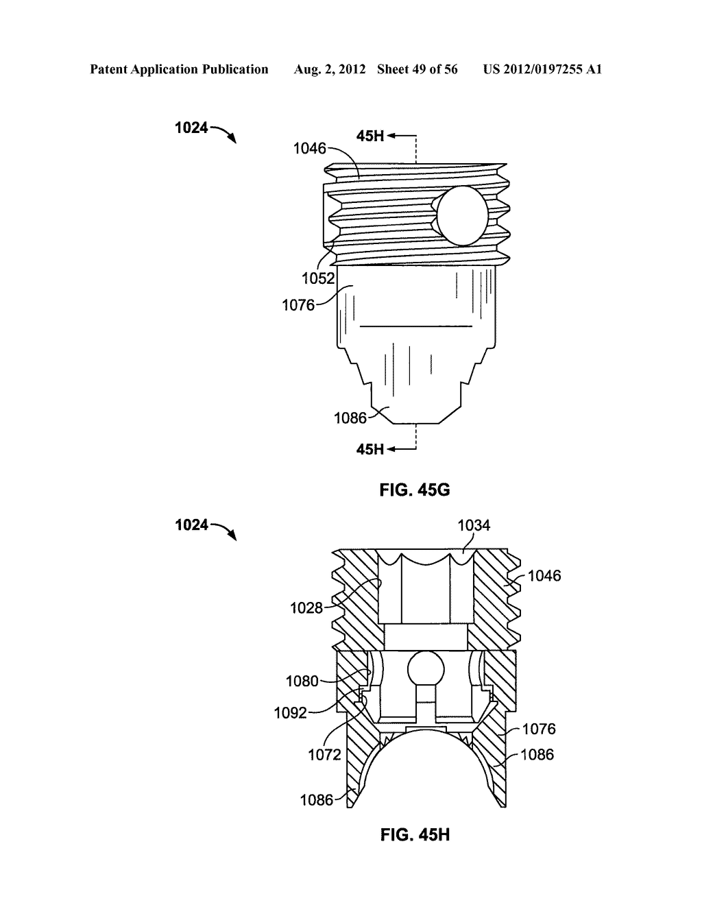 Lockable Intramedullary Fixation Device - diagram, schematic, and image 50