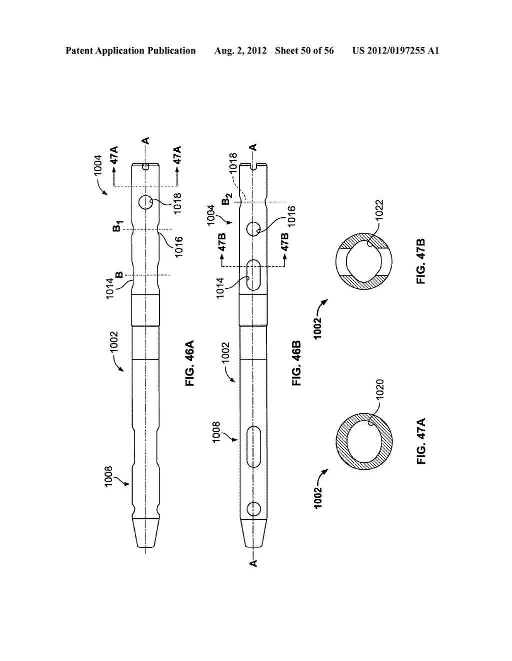 Lockable Intramedullary Fixation Device - diagram, schematic, and image 51