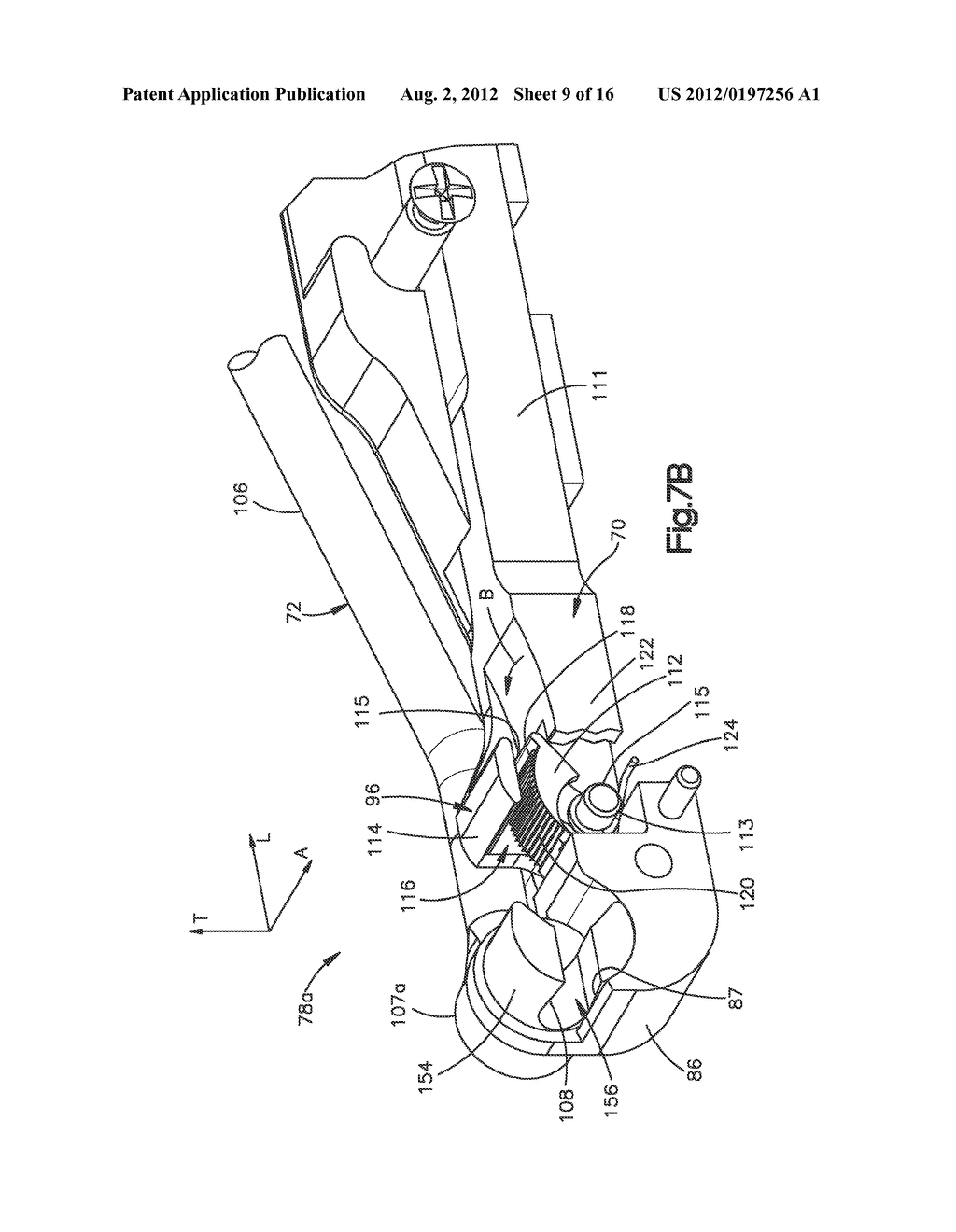 BONE FIXATION ASSEMBLY - diagram, schematic, and image 10