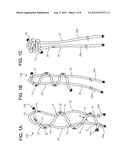 TISSUE REPAIR diagram and image