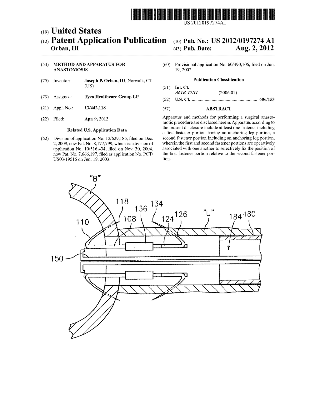 METHOD AND APPARATUS FOR ANASTOMOSIS - diagram, schematic, and image 01