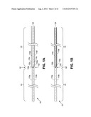 VARIABLE DENIER YARN AND SUTURE diagram and image