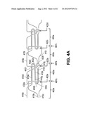 VARIABLE DENIER YARN AND SUTURE diagram and image