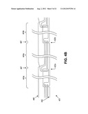 VARIABLE DENIER YARN AND SUTURE diagram and image