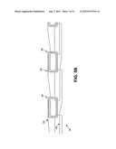 VARIABLE DENIER YARN AND SUTURE diagram and image